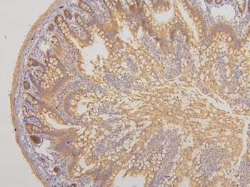 Anti-RAB3GAP2 Antibody