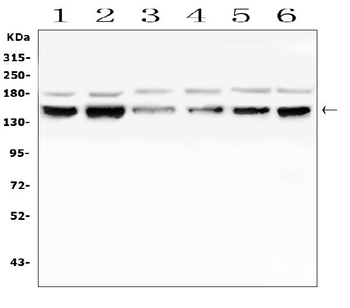 Anti-RAB3GAP2 Antibody