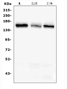 Anti-RAB3GAP2 Antibody