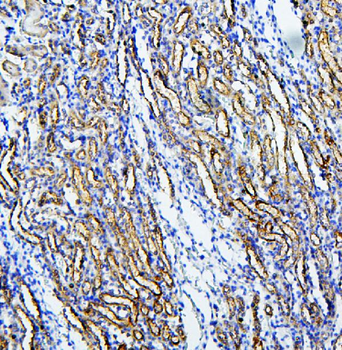 Anti-MUC20 Antibody
