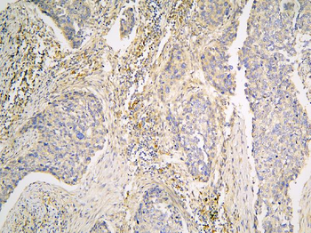 Anti-Pyrophosphatase 1/PPA1 Antibody
