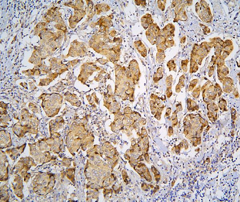 Anti-Pyrophosphatase 1/PPA1 Antibody