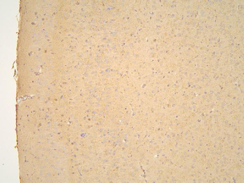 Anti-Pyrophosphatase 1/PPA1 Antibody