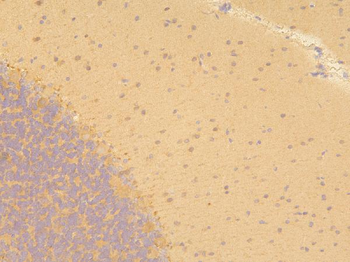 Anti-Pyrophosphatase 1/PPA1 Antibody