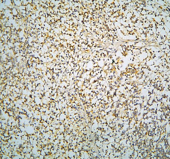 Anti-R-Cadherin-4 CDH4-Antibody