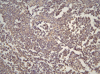 Anti-HOOK3 Antibody