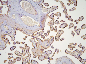 Anti-HOOK3 Antibody