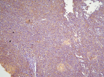 Anti-HOOK3 Antibody