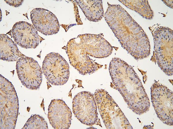 Anti-HOOK3 Antibody