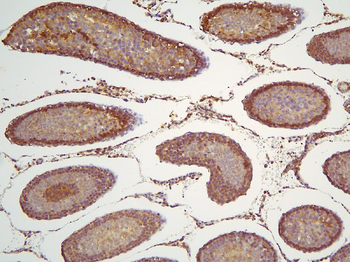Anti-HOOK3 Antibody