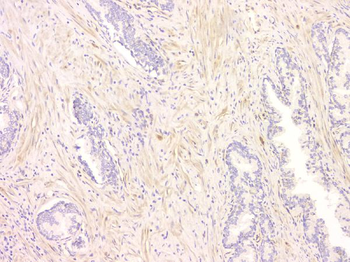 Anti-SRCIN1 Antibody