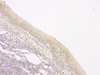 Anti-SRCIN1 Antibody