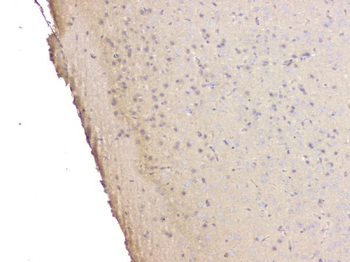 Anti-SRCIN1 Antibody