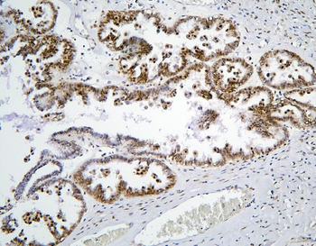 Anti-BHC80/PHF21A Antibody
