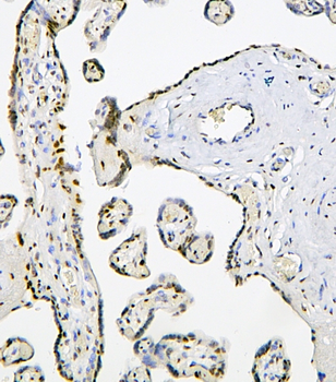 Anti-BHC80/PHF21A Antibody