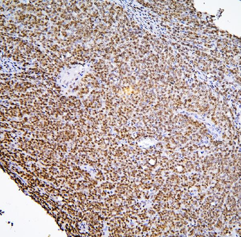 Anti-BHC80/PHF21A Antibody