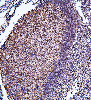 Anti-BHC80/PHF21A Antibody