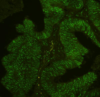 Anti-BHC80/PHF21A Antibody