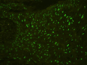 Anti-BHC80/PHF21A Antibody