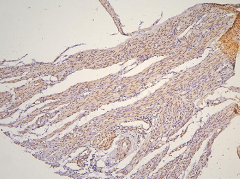Anti-BHC80/PHF21A Antibody