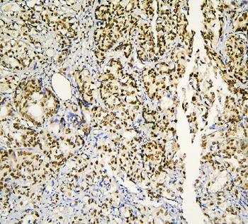 Anti-BHC80/PHF21A Antibody