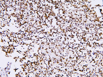 Anti-BHC80/PHF21A Antibody