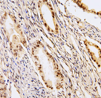 Anti-BHC80/PHF21A Antibody
