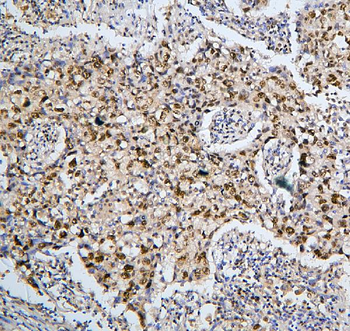 Anti-BHC80/PHF21A Antibody