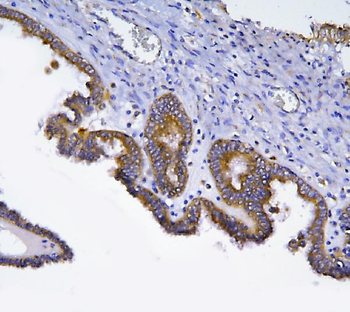 HOOK2 Antibody