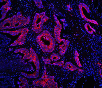 TDRD3 Antibody