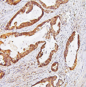TDRD3 Antibody