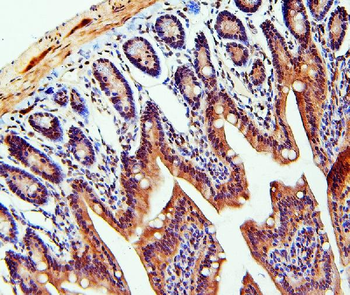 TDRD3 Antibody