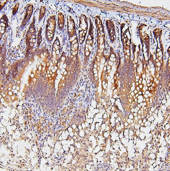 TDRD3 Antibody