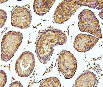 Anti-PEF1 Antibody