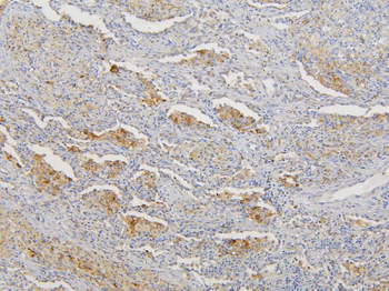 Anti-RNF123 Antibody