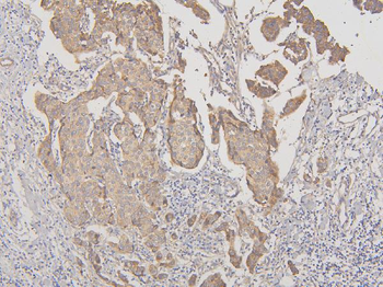 Anti-RNF123 Antibody