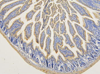 Anti-RNF123 Antibody