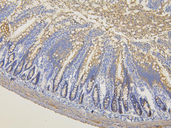 Anti-RNF123 Antibody