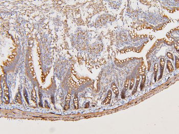 Anti-ATP5G1,2,3/ATP5MC1,2,3 Antibody