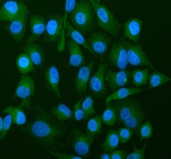 Anti-ATP5G1,2,3/ATP5MC1,2,3 Antibody