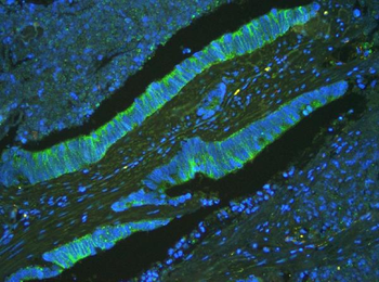 Anti-ATP5G1,2,3/ATP5MC1,2,3 Antibody