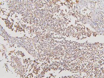 Anti-ATP5G1,2,3/ATP5MC1,2,3 Antibody