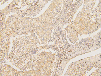 Anti-ATP5G1,2,3/ATP5MC1,2,3 Antibody