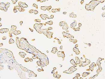 Anti-ATP5G1,2,3/ATP5MC1,2,3 Antibody