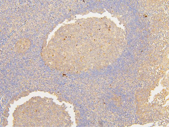 Anti-ATP5G1,2,3/ATP5MC1,2,3 Antibody