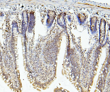 Anti-RNF169 Antibody