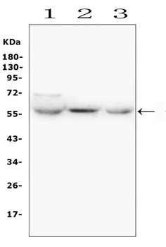 GLUT6/SLC2A6 Antibody