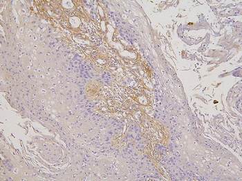 RBMS3 Antibody