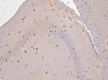RBMS3 Antibody