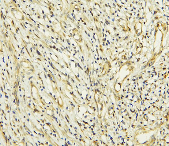 Anti-CCDC36 Antibody